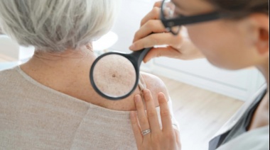Trujillo: Liga Contra el Cáncer y Yanbal realizarán más de 200 despistajes de cáncer de piel