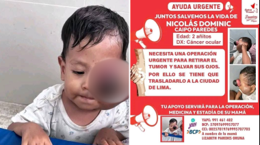 Menor de 2 años con cáncer ocular requiere urgente traslado a Lima para tratamiento especializado