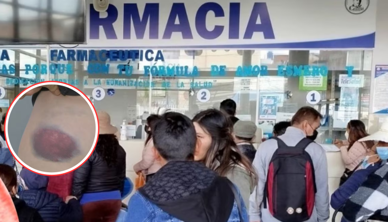 Crisis del Factor IX: pacientes con hemofilia llevan meses sin tratamiento en el Minsa y EsSalud