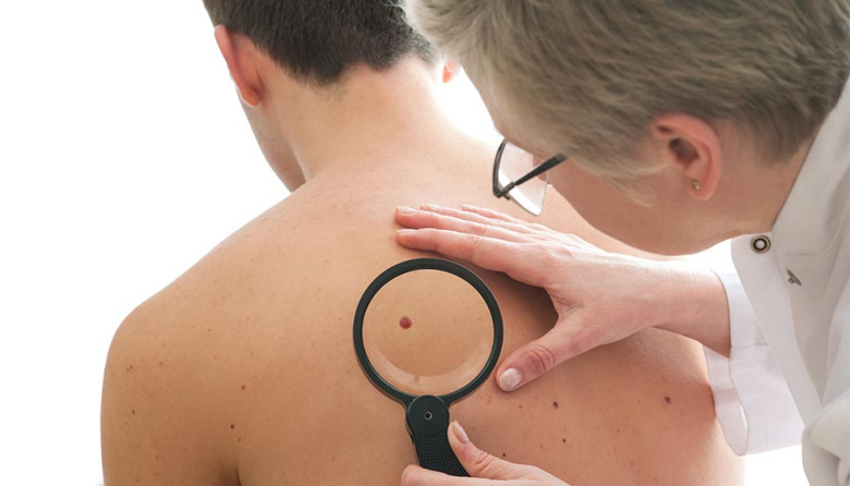 Vacuna personalizada contra el cáncer de piel avanza tras resultados positivos en fase 3