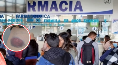 Crisis del Factor IX: pacientes con hemofilia llevan meses sin tratamiento en el Minsa y EsSalud