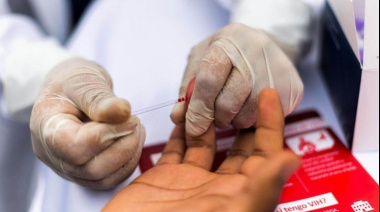 Perú registra más de 10 mil diagnósticos de VIH cada año
