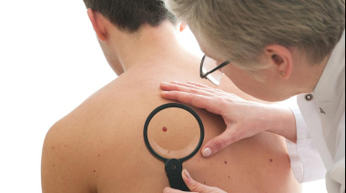 Vacuna personalizada contra el cáncer de piel avanza tras resultados positivos en fase 3
