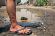 Alerta sanitaria: leptospirosis deja nueve fallecidos y más de 1200 contagios en el país